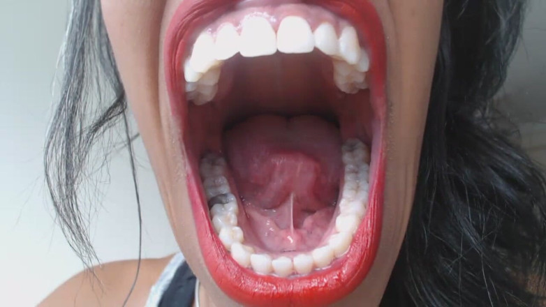 Golden lace: Mouth Viewing