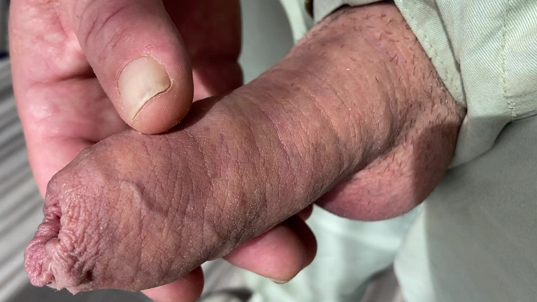 Foreskinguy: Close up mastrubatie grote onbesneden paddenstoelen pik