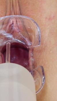 Ujian serviks cayla lyons si pirang muda gemuk oleh 2 dokter