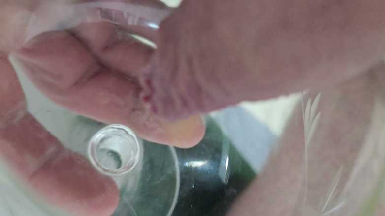 Onwdomu3: Macro Long Foreskin Sikanie