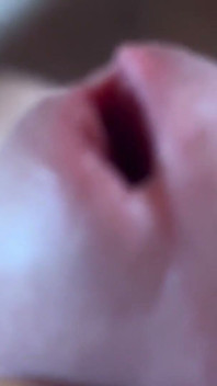 Mokrý žalud se rozšiřuje zblízka!