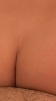 애널 스트레칭 후 헐렁한 젖은 튀어나온 로즈버드 Prolapse