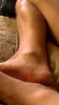 Kaus kaki di beberapa kaki muncrat