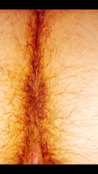 A Butt That Hairy