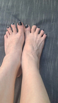 Do We See How Beguiled My Throbbing Foot Veins Are
