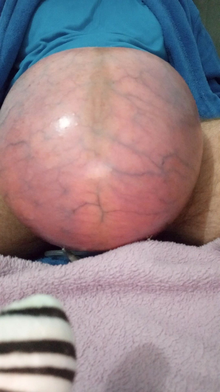 Lion big balls: Không khí cực đoan