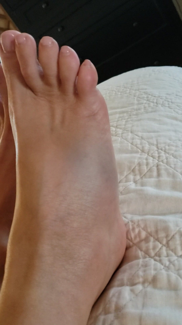 JessRyan: Oh No! MILF Camgirl Jess Ryan Foot Problems