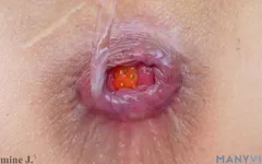 Cereais de jasmim