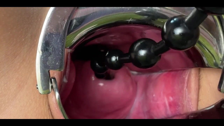 Crazywifeslut: Close up Gyno Masturbation