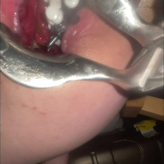 No limit cbt slave: Thumtacks doen pijn