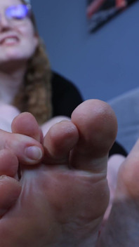 Ginger's Freezing Hurting Feet Nightmare