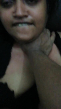 Kesan Pancutan muka Bhabhi Desi