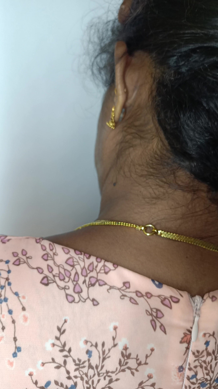 Laxi ammu: Personál kanceláře