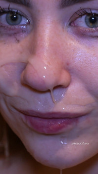 Teen with Braces