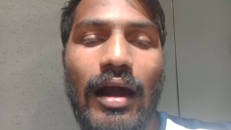 Kumbha Manoj Kumar: We Not Contract on Hospital Nurse Working Just Taking Entertainment...