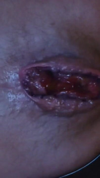 My Hole