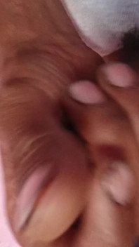 Small Penis