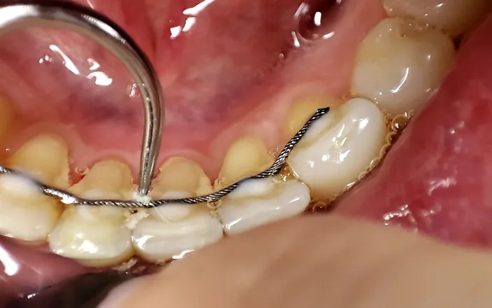 Princess18_: Cleaning Teeth with Toothbrush, Irrigator, Dental Hook