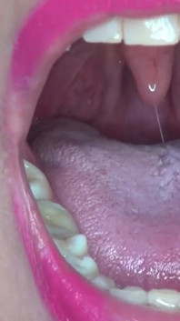Showing My Super Power to You!!!! Super Uvula