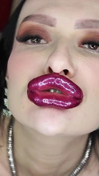 Lip Job on Big Cock Immediately After Lip Augmentation