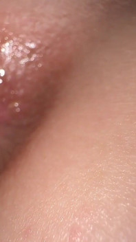 Strange Trends 18 Years Old Girl Got a Tattoo of Dark Anal Pigmentation