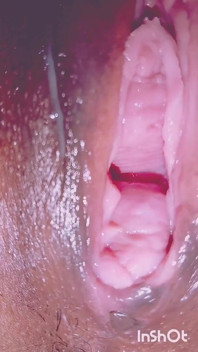 Open Vagina