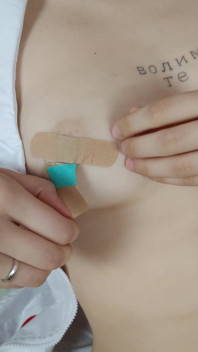 긴 교대 근무 후 발 뒤꿈치에 더티 토크 간호사