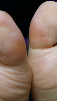 My Feet Are Now Sweaty
