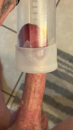 Cox Cummin: Bombeo del pene