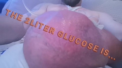 Monster_Meat_: Mengisi glukosa 2 liter