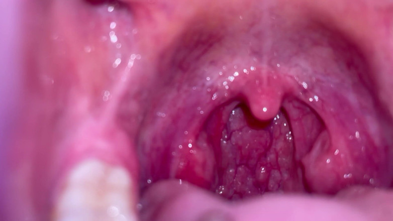 Glitterqueen1999: Prohlídka úst Goth Girl Uvula Tonsils zuby jazyk