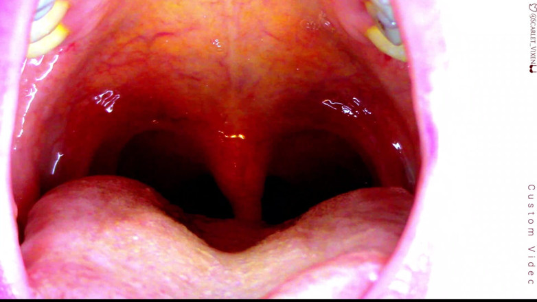 Scarlet Vixen: Sexy Scarlet diz ahhhh - Uvula Showoff