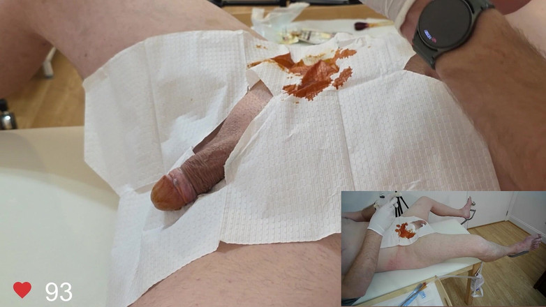 Clinical Climax: Catheter Insertion