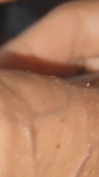 Curious Close-up of Pre-cum in Flaccid Phimosis.