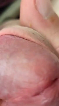 Detailní výstřik