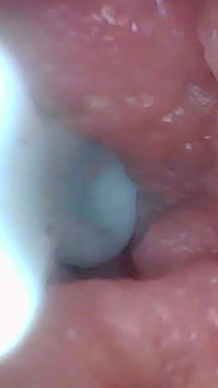 Hai să aruncăm o privire în pizda mea suculentă împreună (cameră endoscop)