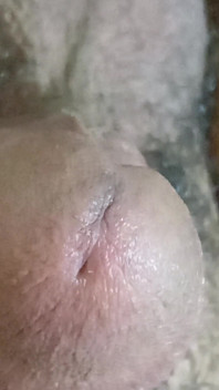 My Dick