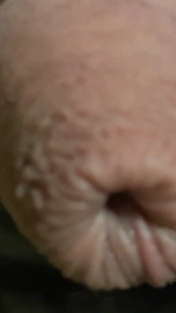 Party Dick