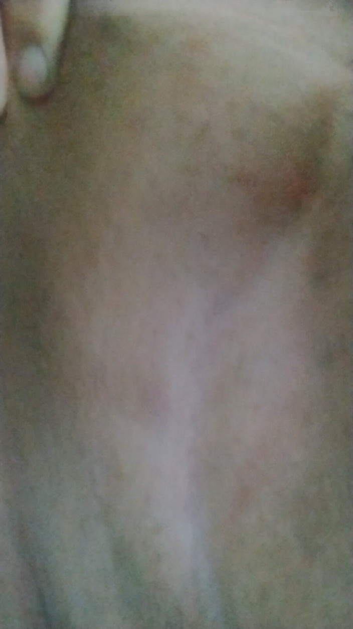 JG Risk: 3-8-2026 Pertunjukan Taint