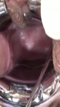 You Are My Gynecologist Part 2