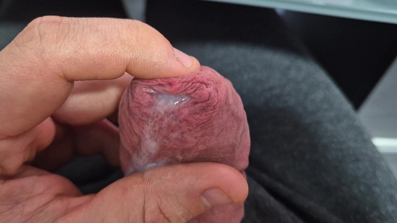 GloomyChase977: Sünnetsiz sıkı fümoz yarak erken boşalmalı sünnetsiz aşıkları azdırıyor