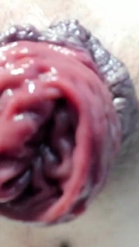 Sto pompando l'ano distrutto e il prolasso anale