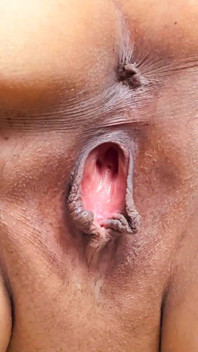Âm hộ mẹ kế banh âm hộ kéo dài âm hộ, nó trở thành âm hộ mở rộng trước khi banh ra, âm hộ banh rộng âm hộ