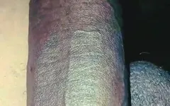 Blackdick