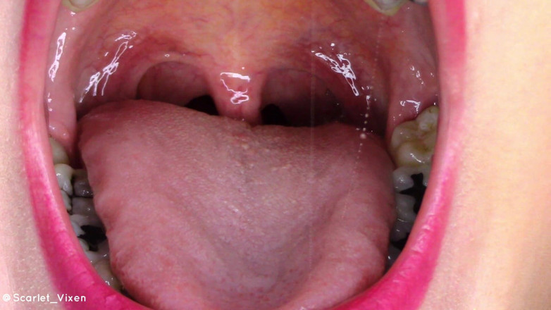 Scarlet Vixen: Uvula biegt sich und vibriert