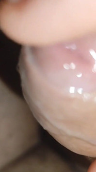 Young Man with Phimosis Opening the Glans