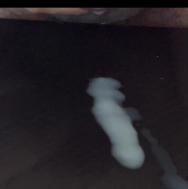 What Does Sperm Experience in Slow Motion? (Syigit)