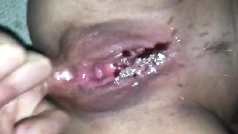 Triple AAA: One Finger Fuck Anal Loving MILF Squirting - POV Closeup and...