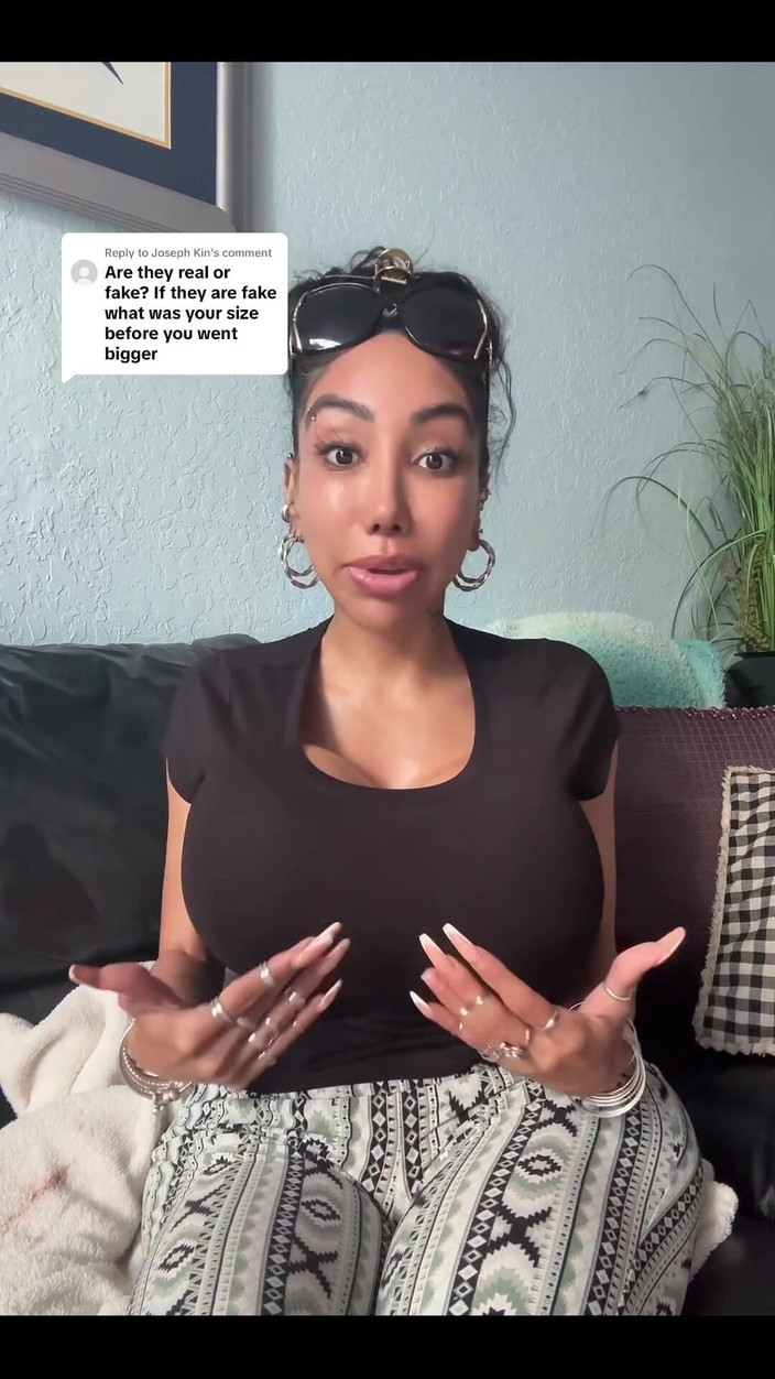 Anakaliyah: Solo quiero compartir mi cirugía plástica