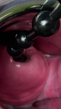 Crazywifeslut cervix y mirilla jugar